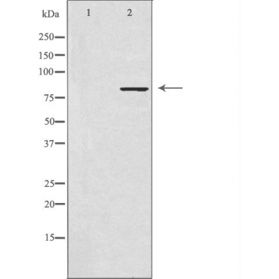 NADAP Antibody - Western blot analysis of extracts from HUVEC cells, using NADAP antibody.