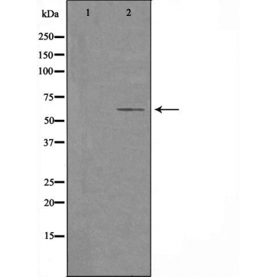 Cytochrome P450 2U1 Antibody - Western blot analysis of extracts from HeLa cells using Cytochrome P450 2U1 antibody.