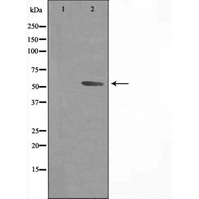 Cytochrome P450 3A43 Antibody - Western blot analysis of extracts from Jurkat cells, using Cytochrome P450 3A43 antibody.