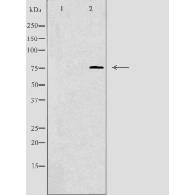 KAL1 Antibody - Western blot analysis of extracts from HuvEc cells, using KAL1 antibody.