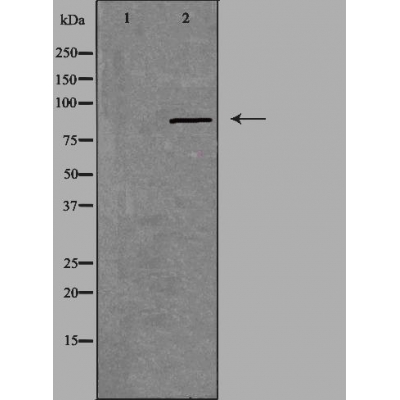 CSGLCAT Antibody - Western blot analysis of extracts from Jurkat cells, using CSGLCAT antibody.