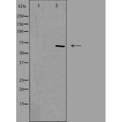 TESK1 Antibody - Western blot analysis of extracts from rat heart cells using TESK1 antibody.
