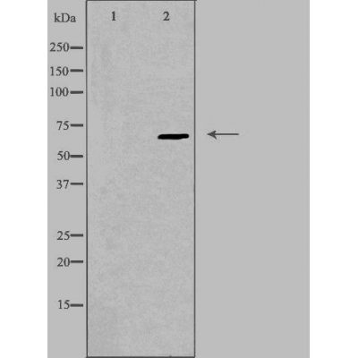 EPN2 Antibody - Western blot analysis of extracts from HepG2 cells using EPN2 antibody.