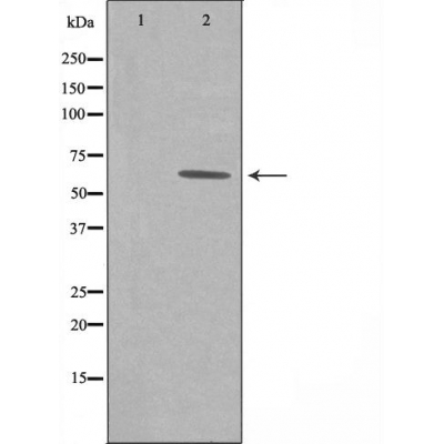 GRB14 Antibody - Western blot analysis of extracts from COLO cells using GRB14 antibody.