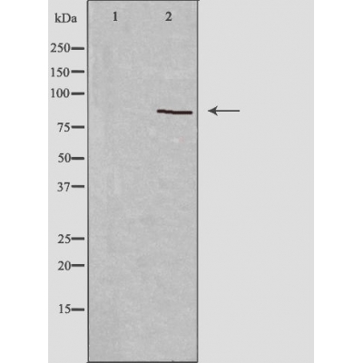 GIDRP88 Antibody - Western blot analysis of extracts from Jurkat cells using GIDRP88 antibody.