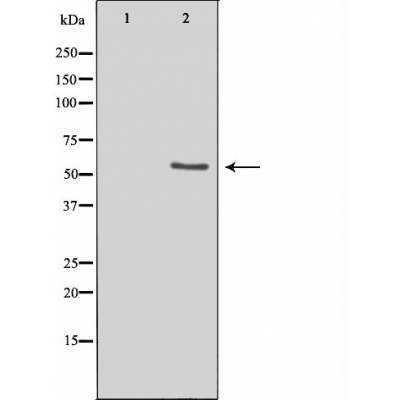 LIPI Antibody - Western blot analysis of extracts from COLO cells, using LIPI antibody.