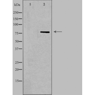 NDUFS1 Antibody - Western blot analysis of NDUFS1 in  293 whole cell lysates,The lane on the left was treated with the antigen-specific peptide.