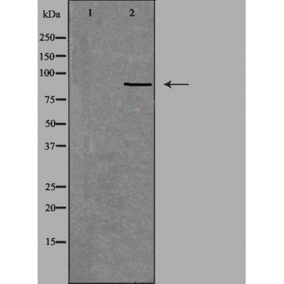 NOX5 Antibody - Western blot analysis of extracts from Jurkat cells, using NOX5 antibody.