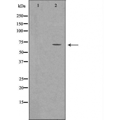 SLC22A5 Antibody - Western blot analysis of extracts from Rat Heart cells using SLC22A5 antibody.