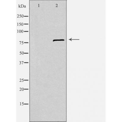 SLC6A15 Antibody - Western blot analysis of extracts from Jurkat cells, using SLC6A15 antibody.
