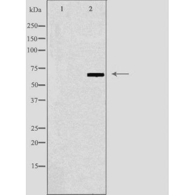 N4BP2L2 Antibody - Western blot analysis of extracts from LOVO cells, using N4BP2L2 antibody.