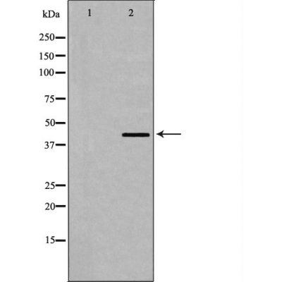 Dematin Antibody - Western blot analysis of Dematin expression in HeLa whole cell.