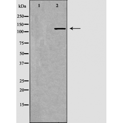 PIK3CG Antibody - Western blot analysis of Jurkat using PIK3CG antibody.