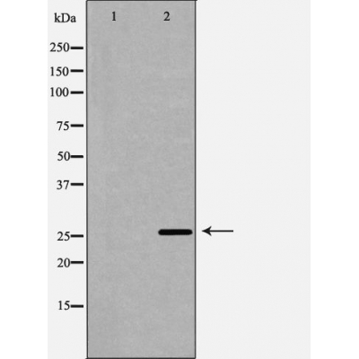 TREM1 Antibody - Western blot analysis of extracts from mouse kidney tissue, using TREM antibody.