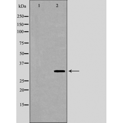 TNFRSF6B Antibody - Western blot analysis of 293  lysates using TNFRSF6B antibody.