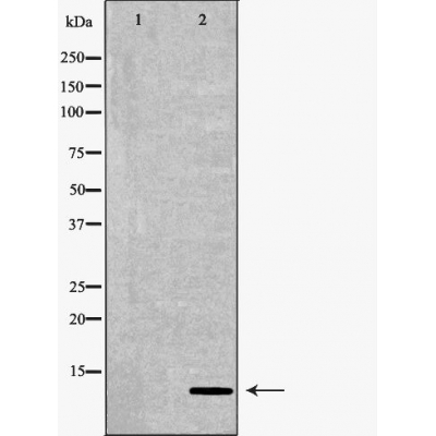 S100B Antibody - Western blot analysis of A375  lysates using S100B antibody.