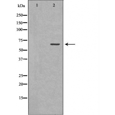 GAD2 Antibody - Western blot analysis of human brain  lysates using GAD2 antibody.