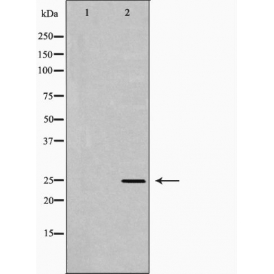 RAN Antibody - Western blot analysis of lovo cell lysates, using RAN Antibody.