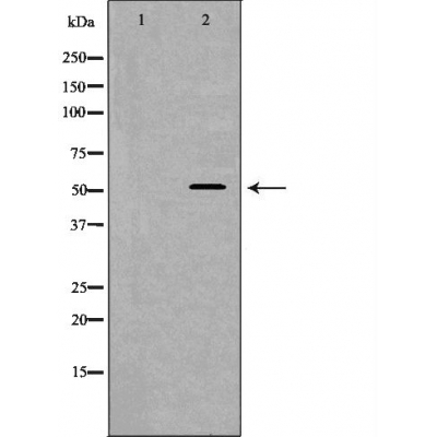WASP Antibody - Western blot analysis of lovo cell lysates, using WAS  Antibody.