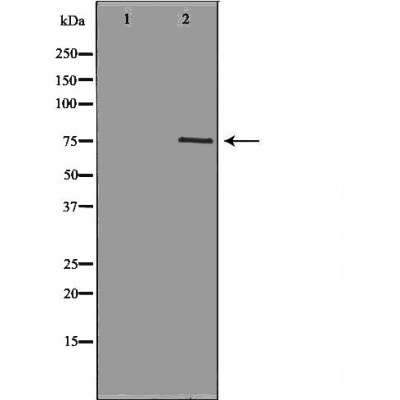 NEK8 Antibody - Western blot analysis of Hela whole cell lysates, using NEK8 Antibody.