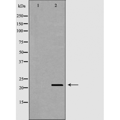 RNASE11 Antibody - Western blot analysis of MCF-7  lysates using RNASE11 antibody.