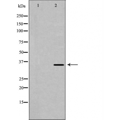 TNNT2 Antibody - Western blot analysis of 293T  lysates using TNNT2 antibody.