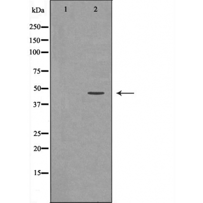 NCF1/p47-phox Antibody - Western blot analysis of T47D  lysates using NCF1 antibody.