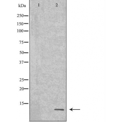 NEDD8 Antibody - Western blot analysis of Hela whole cell lysates, using NEDD8 Antibody.