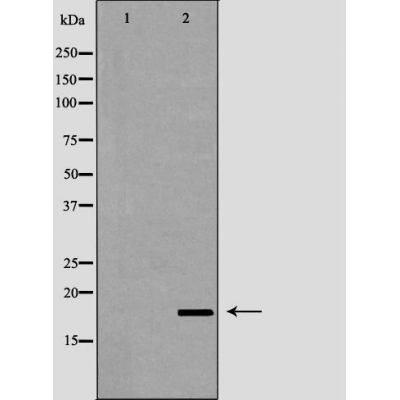 LCN6 Antibody - Western blot analysis of 721_B  lysates using LCN6 antibody.