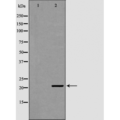 ITPA Antibody - Western blot analysis of Hepg2 whole cell lysates, using ITPA Antibody.