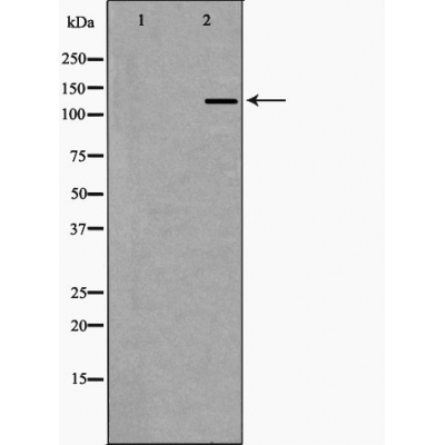 EHMT2 Antibody - Western blot analysis of Hela whole cell lysates, using EHMT2 Antibody.
