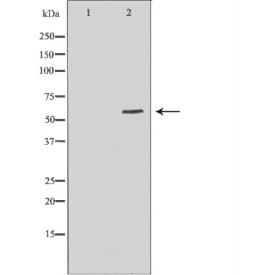 MITF Antibody - Western blot analysis of Hela whole cell lysates, using MITF Antibody.