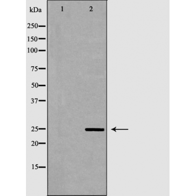 SOD2/MnSOD Antibody - Western blot analysis of extracts from K562, using SOD2 antibody.