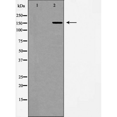 nNOS Antibody - Western blot analysis of Huvec whole cell lysates, using NOS1 Antibody.