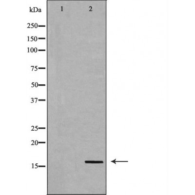 Survivin Antibody - Western blot analysis of Hela whole cell lysates, using BIRC5 Antibody.