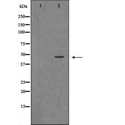 Renin Antibody - Western blot analysis of Hepg2 whole cell lysates, using REN Antibody.