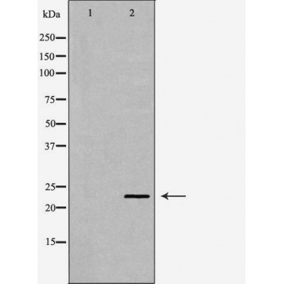 RBP4 Antibody - Western blot analysis of Mouse liver tissue lysates, using RBP4 Antibody.