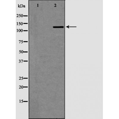 ERCC5 Antibody - Western blot analysis of extracts from fetal brainlysates, using ERCC5 antibody.