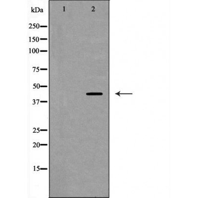 SELL Antibody - Western blot analysis of Jurkat whole cell lysates, using SELL Antibody.
