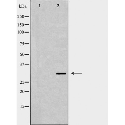 XPA Antibody - Western blot analysis of extracts from HEK-293, using XPA antibody.