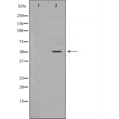 HNRNPK Antibody - Western blot analysis of extracts from HeLa, using HNRNPK antibody.