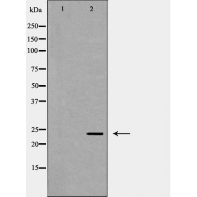 POLR2E Antibody - Western blot analysis of MCF7 cell lysates, using POLR2E Antibody.