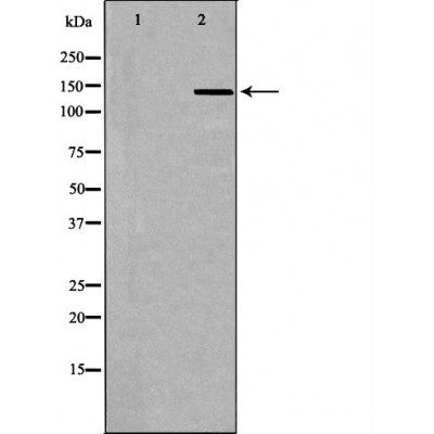 IL16 Antibody - Western blot analysis of A549 whole cell lysates, using IL16 Antibody.