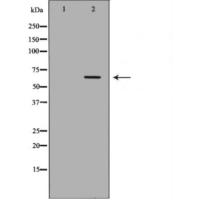 FANCC Antibody - Western blot analysis of Hela whole cell lysates, using FANCC Antibody.
