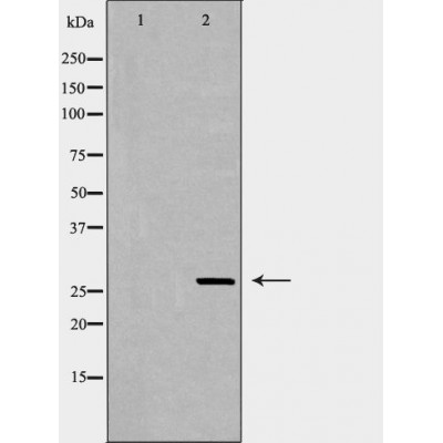 EIF6 Antibody - Western blot analysis of COLO320 cell lysates, using EIF6  Antibody.