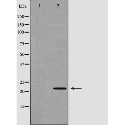 Peroxiredoxin 1 Antibody - Western blot analysis of Hela whole cell lysates, using PRDX1 Antibody.