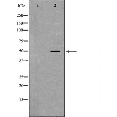 CADM1 Antibody - Western blot analysis of Mouse brain lysates, using CADM1 Antibody.
