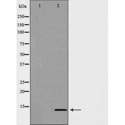 MSMB Antibody - Western blot analysis of HepG2 cell lysates, using MSMB Antibody.