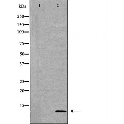 S100A10 Antibody - Western blot analysis of SW480 cell lysates, using S100A10 Antibody.
