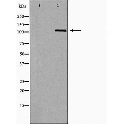 OGT Antibody - Western blot analysis of Hela whole cell lysates, using OGT Antibody.